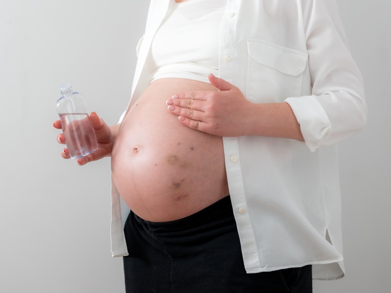 Coconut Oil During Pregnancy