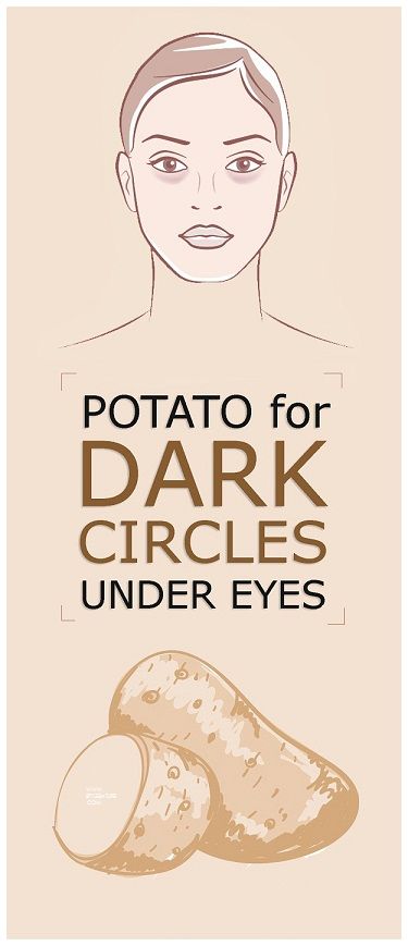 Potato For Dark Circles Under Eyes