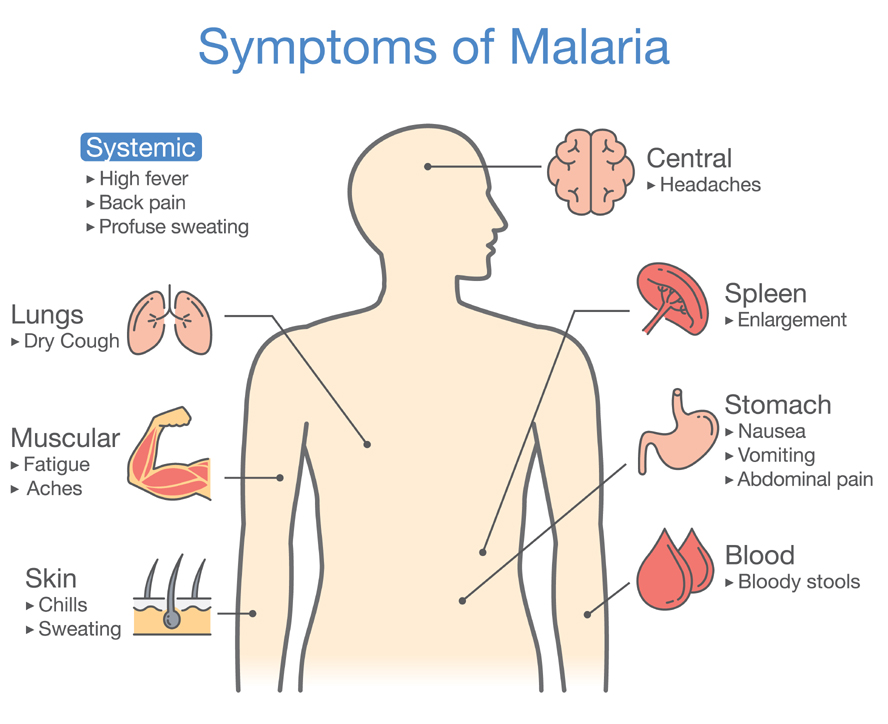 Malaria Symptoms And Treatment