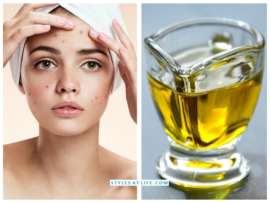 How To Use Almond Oil For Acne Scars?