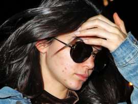15 Latest Kendall Jenner without Makeup Images!