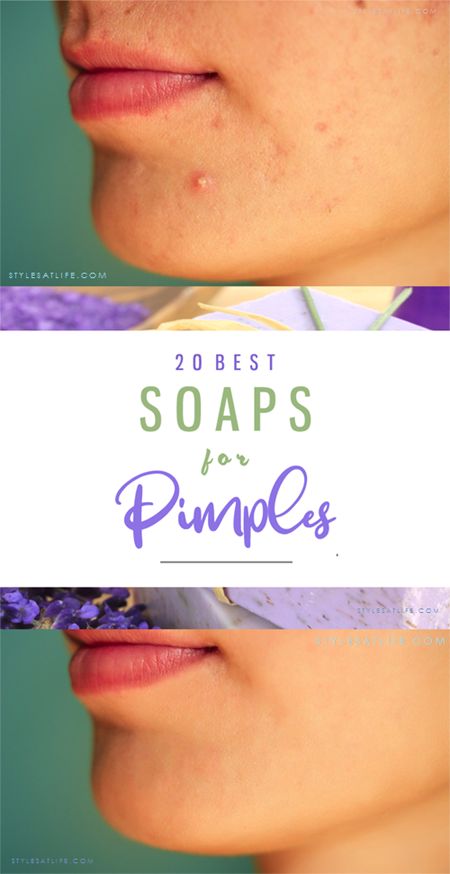 Best Soaps For Pimples