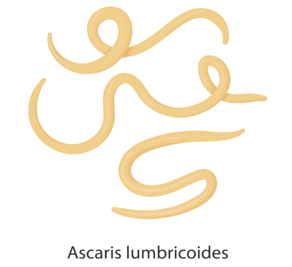 Ascariasis Roundworms