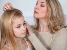 How to Get Rid of Head Lice with These Trusted Home Remedies